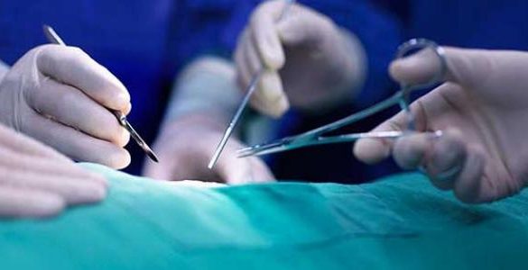 تضييق المهبل في تركيا