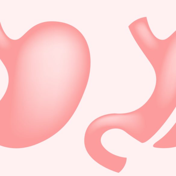 جراحات السمنة