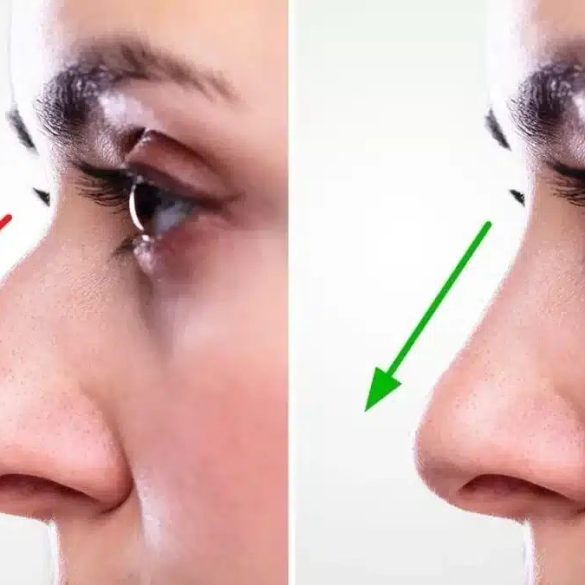 جراح في عمليات تجميل الأنف في مصر