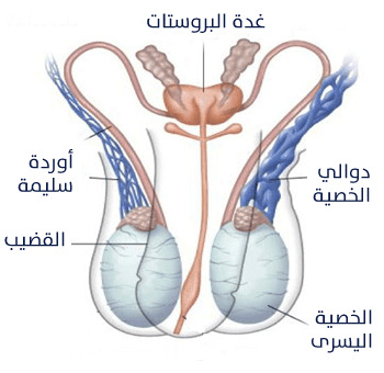 علاج دوالي الخصيتين